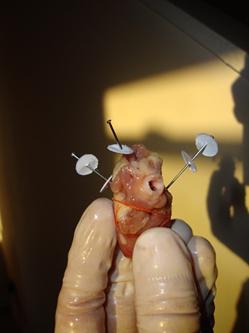 mcnugget heart surgery (study for meat man)