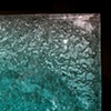 Ablation