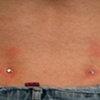 Two fresh dermal anchors on the back dimples.