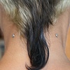 healed dermal anchors on neck