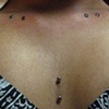 Super healed surface piercing in the middle of the chest.  Two fresh surface piercings, one on either side of the chest.