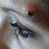 fresh dermal anchor above the left eyebrow