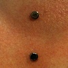Two fresh dermal anchors (the bottom two) the top one is week old(zoomed in view).  A little bruising on the top one there, not uncommon for a dermal anchor in that location.