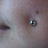 healed cheek piercing with freshly changed bezel set cz (zoomed in)