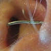 healed tragus to conch industrial.  One year old.  Left ear.