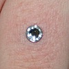 Healed dermal anchor on the ring finger.  6 weeks old. (zoomed in view)