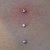 Three healed dermal anchors on the chest.  Just changed the top one to the prong set cz.  Pretty red and cranky, not uncommon for changing an anchor top, especially in that spot.