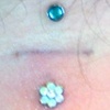 Fresh dermal anchor with flower cz down below.  Super healed dermal anchor with cz up above.
