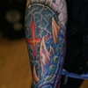 Casey's arm