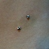 Two anchors on the hip.  Same as the other side.  The one lower down is a week old, and the one higher up is freshly done. (zoomed in view)