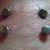One fresh Nape piercing up top.  One SUPER healed Nape piercing in the middle.  One more to come.  (zoomed in view)