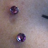 Two four(ish) month old dermal anchors on the face.