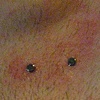 Two Fresh dermal anchors on the left side of the chest. (zoomed in view)