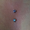 Fresh surface piercing on the chest.