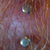 SUPER healed vertical surface piercing on the chin.  We tried this one expecting it to reject, but it never budged!