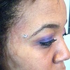 Fresh dermal anchor on the forehead/eyebrow with a cz.