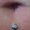 fresh dermal anchor below the navel.  