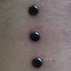 Three very healed surface piercings on the nape.  Her neck was turned a bit and the piercings appear a little diagonal.  When here head is perfectly straight, so are the piercings.