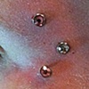 Two fresh dermal anchors on the temple/eyebrow area.  One super healed dermal anchor(the lowest of the three).  The healed one was done by me as well.