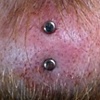 Fresh vertical surface piercing on the chin.