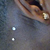 Two healed dermal anchors on the neck/hairline.