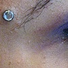 Fresh dermal anchor on the forehead/eyebrow with a cz. (zoomed in view)
