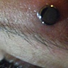 fresh dermal anchor above left eyebrow (zoomed in view)