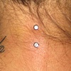 larger view of two nape dermal anchors