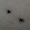 over 6 month old super healed hip surface piercing. (zoomed in view, HIS right side)