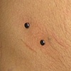 fresh hip surface piercing on the left side(of the photo), two week old surface piercing on the right side(of the photo).