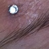 Fresh 18g dermal anchor with cz.  One more to come next to it. (zoomed in view)