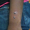 Two fresh dermal anchors on the wrist