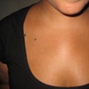 four healed dermal anchors on the chest