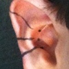 The marks for three conch piercings to be done with Labret studs.