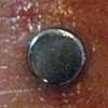 fresh dermal anchor on the finger(zoomed in view)