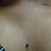 One super healed surface piercing in the middle of the chest.  Marks for two surface piercings, one on either side of the chest.