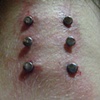 Two fresh Nape piercings (top and bottom).  One SUPER healed Nape piercing in the middle.(zoomed in view)