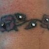One healed 18g dermal anchor, three fresh 18g dermal anchors on the wrist.