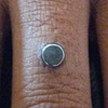 Super healed dermal anchor on the finger.