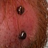 Fresh vertical surface piercing on the chin.  