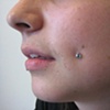 healed cheek piercing with freshly changed bezel set cz