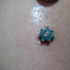 Fresh dermal anchor on the chest with flower gem (zoomed in)
