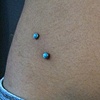 Two very healed surface piercings on the hips.  Freshly changed from Cz's to Jade tops.