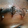 Three fresh eyebrow piercings.  
