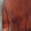 Two one week old dermal anchors on the wrist.  One fresh anchor on the hand, one fresh anchor on the finger.