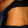Three fresh dermal anchors with cz's on the hip.