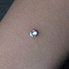 healed dermal anchor on the wrist, freshly changed bezel set cz