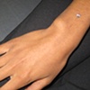 healed dermal anchor on the right wrist.  Freshly changed from the 14 gauge disc back to the 14 gauge cz.