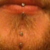 One and a half week old vertical surface piercing on the chin.