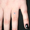 Healed dermal anchor on the ring finger.  6 weeks old.